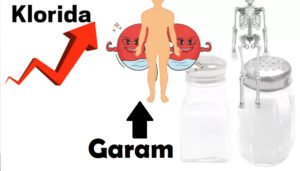Kebanyakan Makan Garam Bisa menyebabkan Osteoporosis, Coba Baca Penjelasan dari Dokter