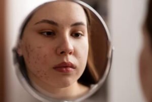 Sebelum Tidur Diharuskan Cuci Muka Dulu, Ini Dianggap Bisa Menghilangkan Jerawat