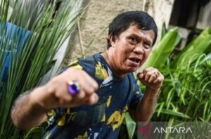 Ellyas Pical Terbaring di Ruang ICU Rumah Sakit Harapan Kita, Ini Penyakit yang Diderita